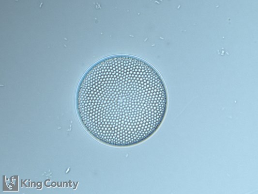 Photo of Coscinodiscus spp.